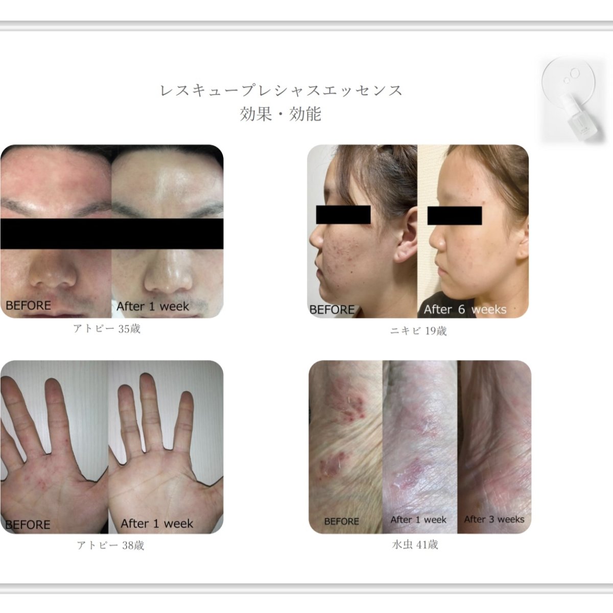 画像5: レスキュー プレシャス エッセンス（30ml) (5)