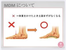 画像4: B品【MDM】(1)Full Sole (4)