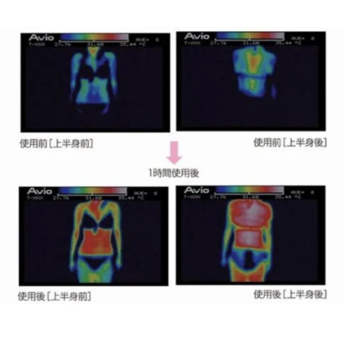 画像2: 【BELEGA】痩身器 フェアリーヴェールプレミアム (2)